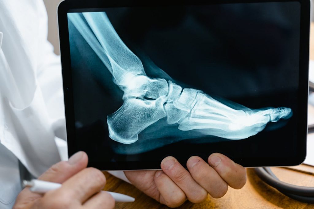 pexels-photo-8376285 A doctor reviews a foot X-ray on a digital tablet in a medical consultation setting.
